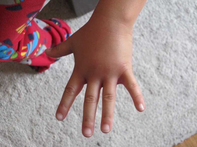 ¿Es cierto que los padres gordos tienen hijos gordos?